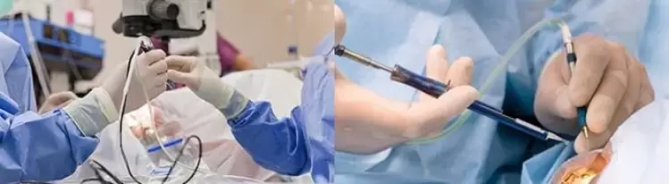 Cirurxía para restaurar a visión